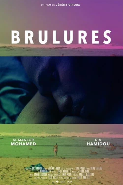 Brûlures